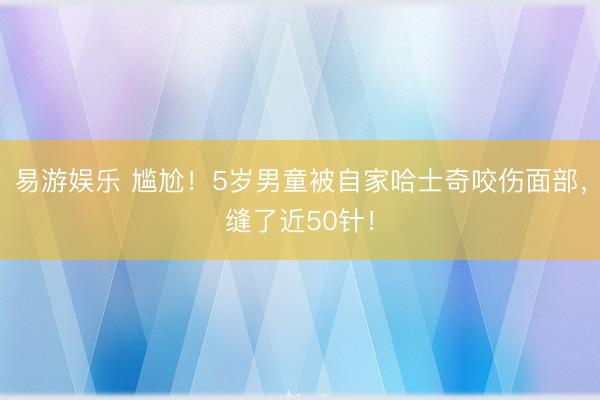 易游娱乐 尴尬！5岁男童被自家哈士奇咬伤面部，缝了近50针！